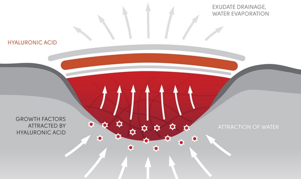 Sourcemed :: wound care | surgical disposals